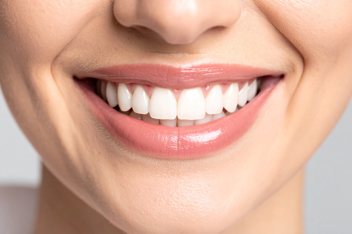 Cosmetic Transformations Aesthetic smile makeover result by Dr. Maria Smith featuring professional cosmetic dentistry and teeth whitening services.